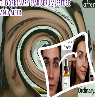 Ordinary lash serum before and after
