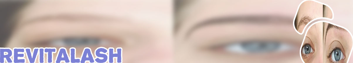 Revitalash eyebrow before and after